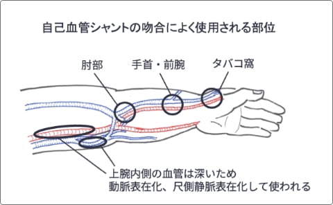 上腕・肘・前腕の手術 [新品] - 健康/医学